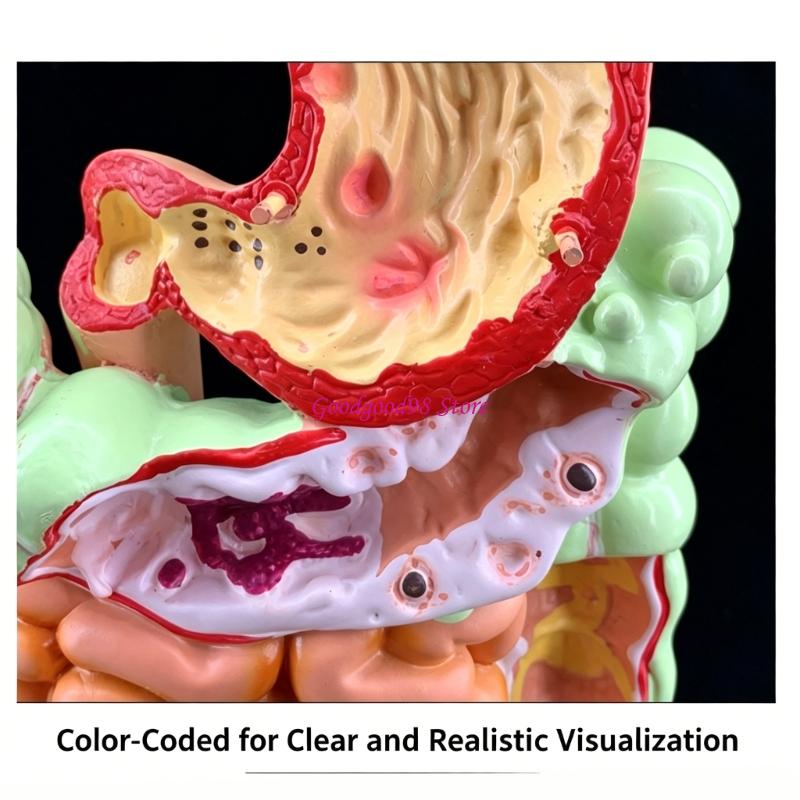 Medical Lab Observer - 3D Pathology Teaching Model, PVC Anatomy