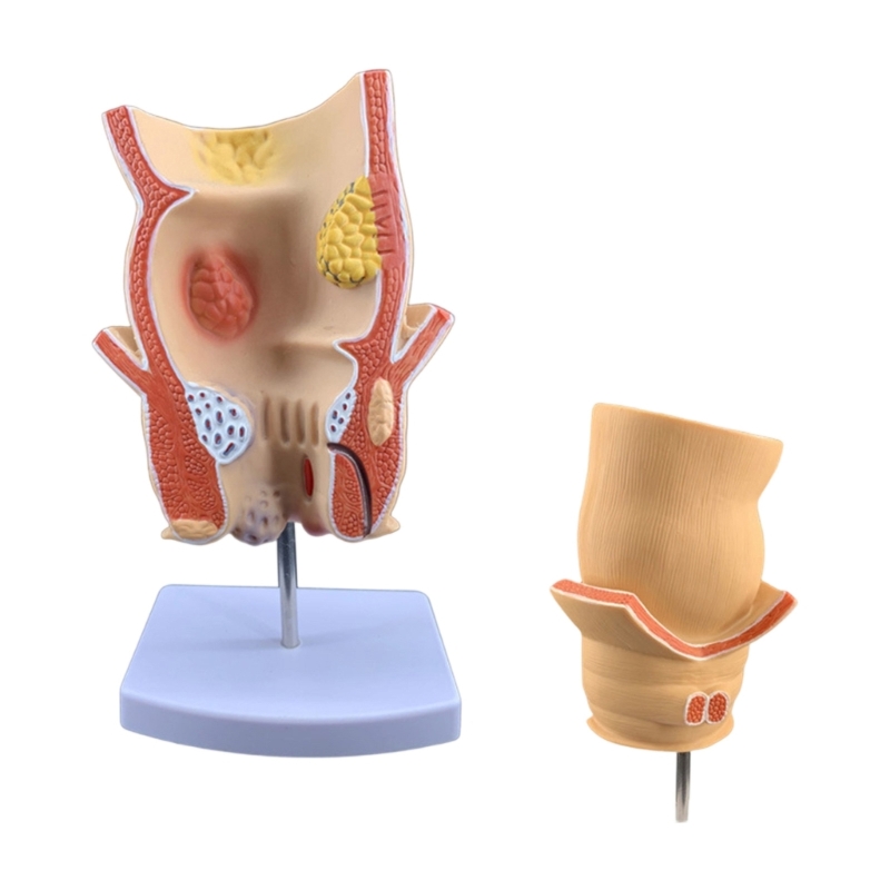 3D Pathology Teaching Model, P - Medical Lab Observer recension och pris