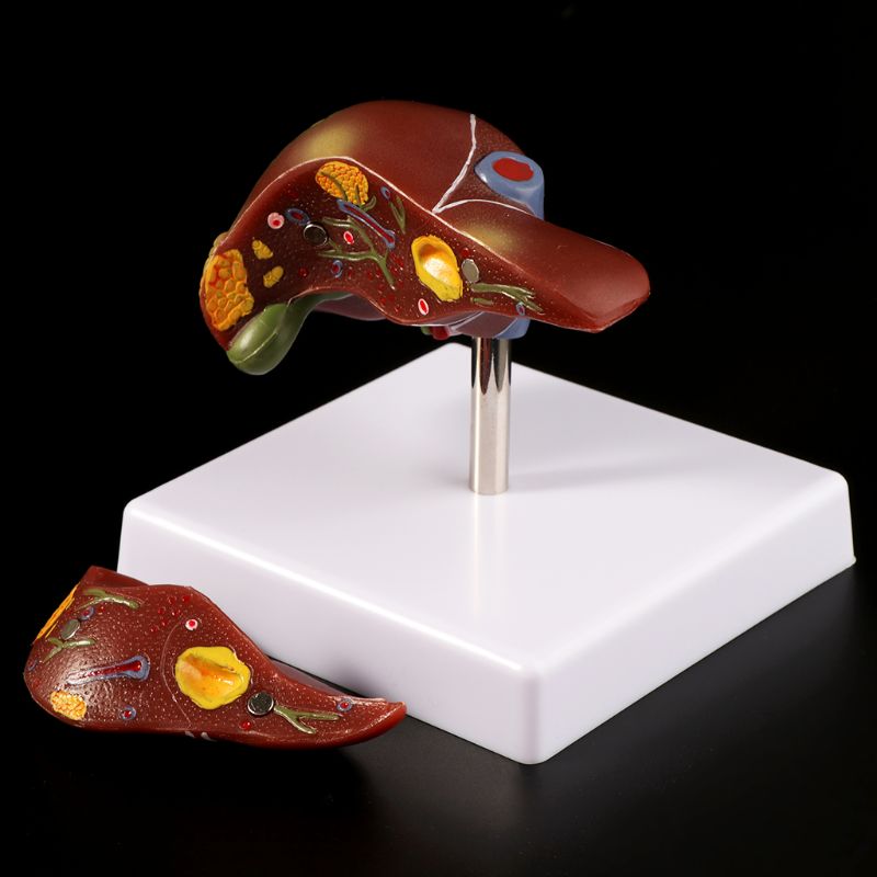 Human Liver Pathological Anato - Medical Lab Technology recension och pris